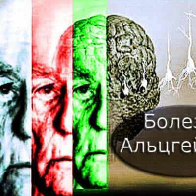 Main bolezn alcgeymera 667x400